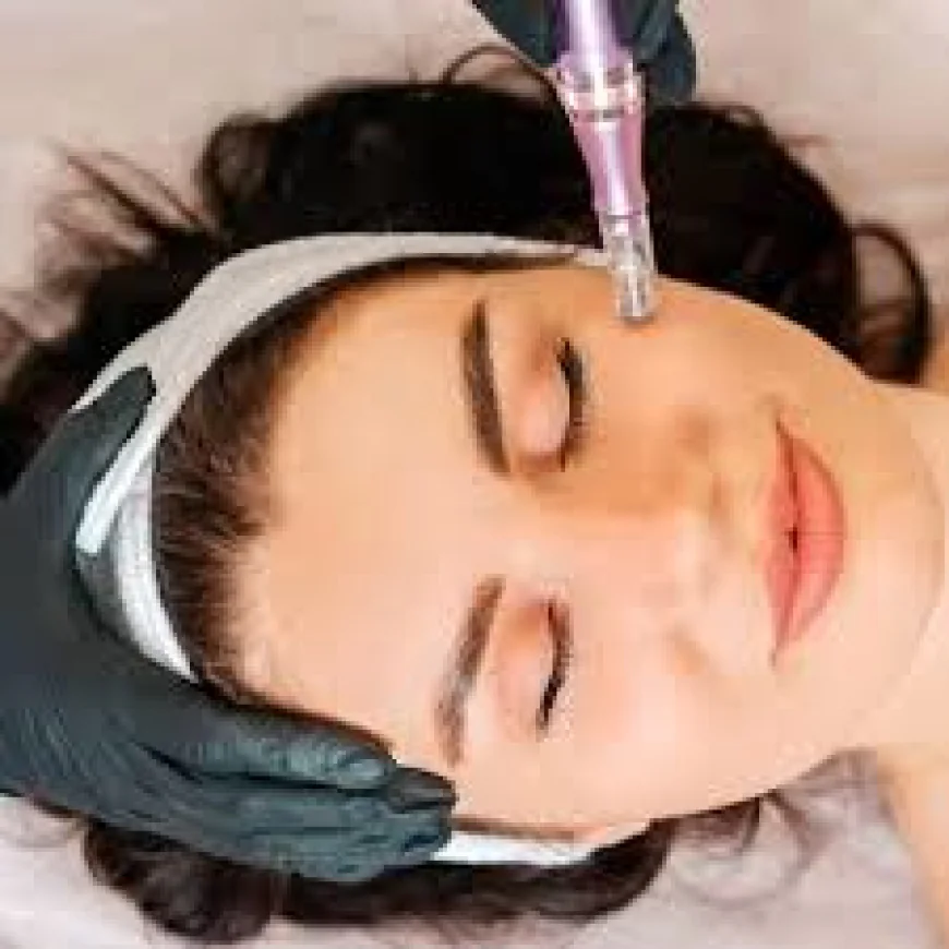 Rejuvenate Your Skin with Microneedling in Islamabad
