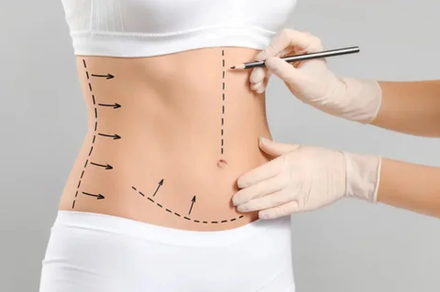 Affordable Tummy Tuck Clinics in Islamabad