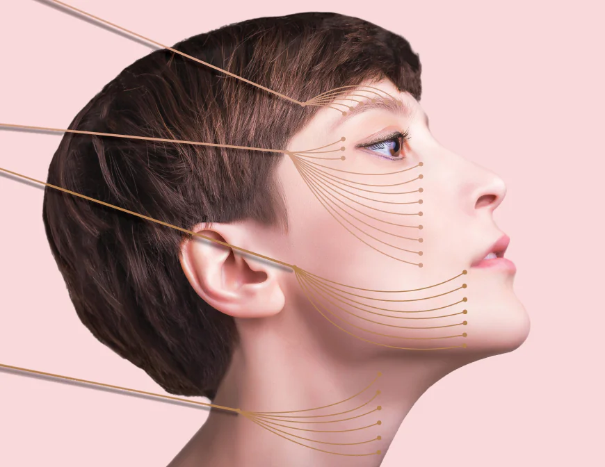 Thread Lift in Islamabad: Non-Surgical Facelift for Youthful Skin