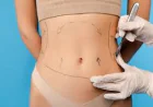 The Benefits of Liposuction in Dubai for Stubborn Fat in Dubai