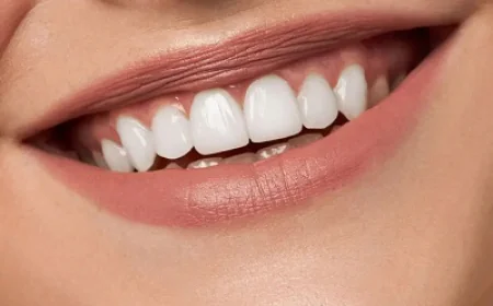 Is Teeth Whitening Painful? Dentist Insights
