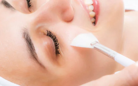 Is Chemical Peeling Safe for All Skin Types? Expert Insights