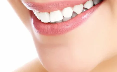 Do Composite Veneers Look Like Natural Teeth?