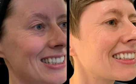 Reframe Beauty with Profhilo from the Best Plastic Surgeon in dubai