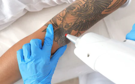 The Complete Guide to Saline Tattoo Removal: A Safer Alternative to Laser Treatments