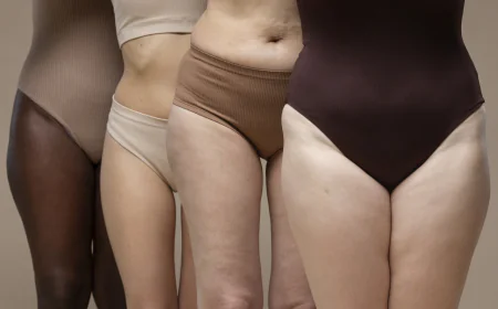 New Advances in Stretch Mark Removal for Different Skin Types