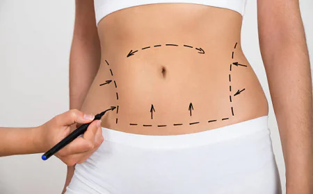How to Find the Best Liposuction Surgeon in Riyadh