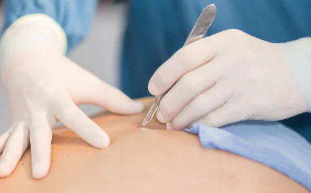 Skin Wart Removal Cost Based on Wart Duration