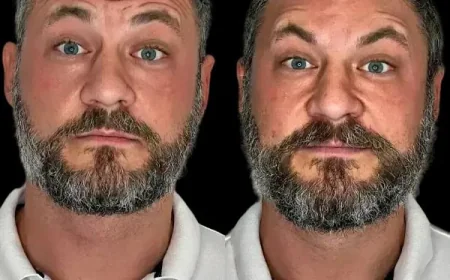 Renew Ageless Charm with Profhilo from Best Plastic Surgeon in dubai