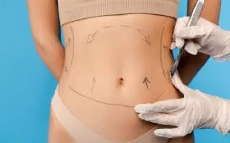 The Benefits of Liposuction in Dubai for Stubborn Fat in Dubai