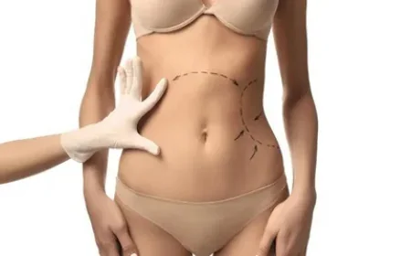 Top Questions About Body Contouring in Islamabad Answered