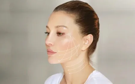 Thread Lift in Islamabad: Side Effects You Should Know