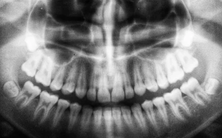 What to Expect From a Panoramic Dental X-Ray Cost Visit