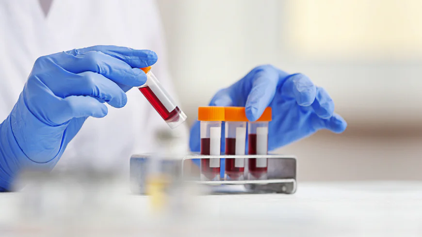 Blood Test at Home for CrossFit Enthusiasts