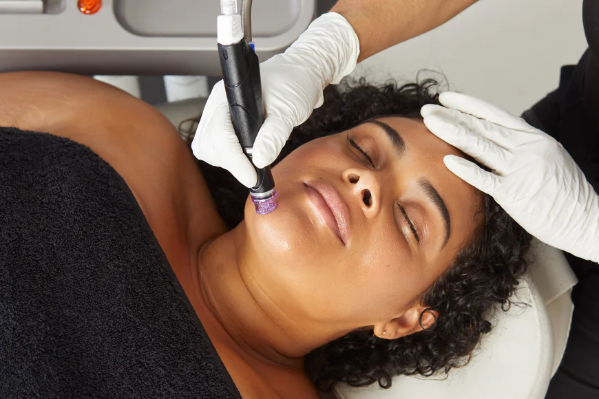 Step Into the Glow Era Now with Dubai Hydrafacial Radiance