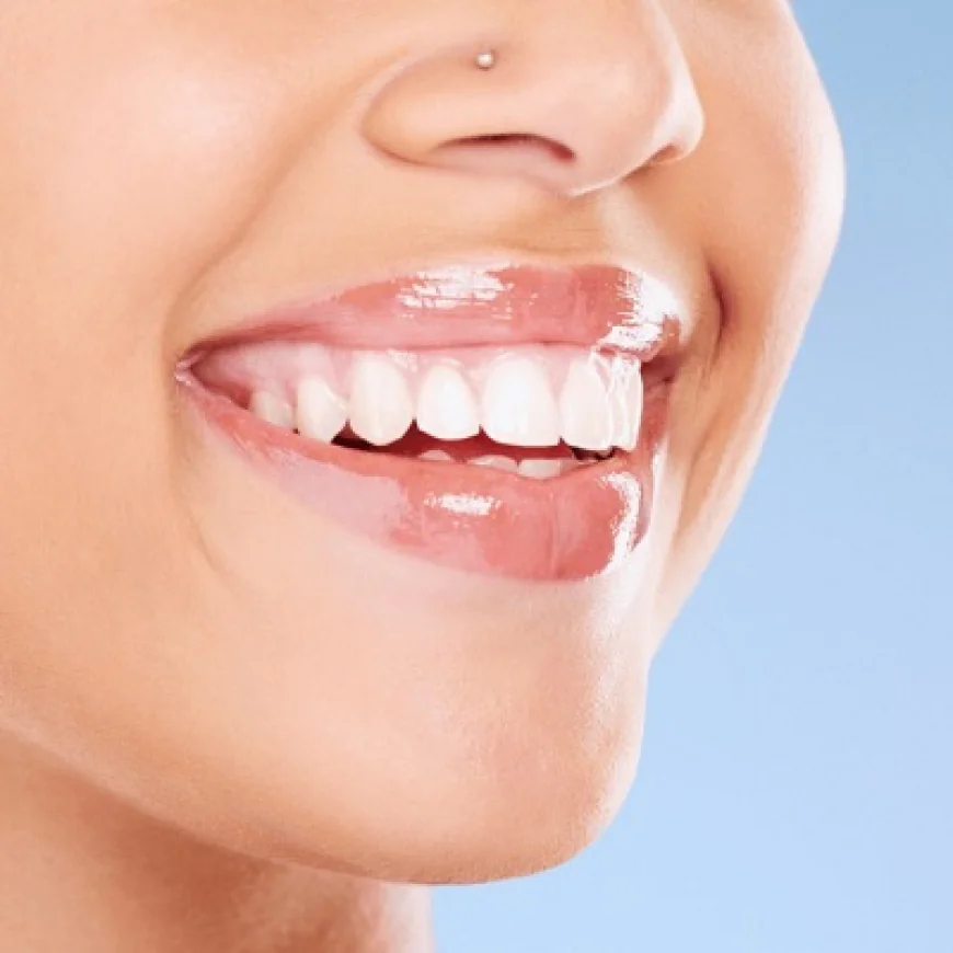 Teeth Whitening: What Causes Teeth to Stain?