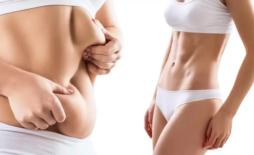 Abdominoplasty in Dubai: Who Is the Right Candidate?