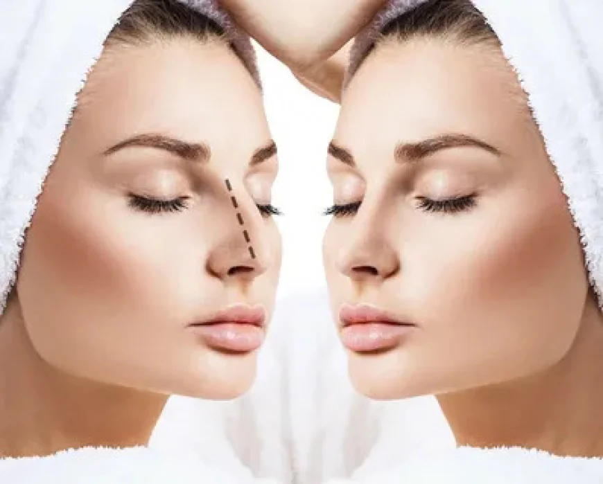 Rhinoplasty Cost Guide for Riyadh Patients