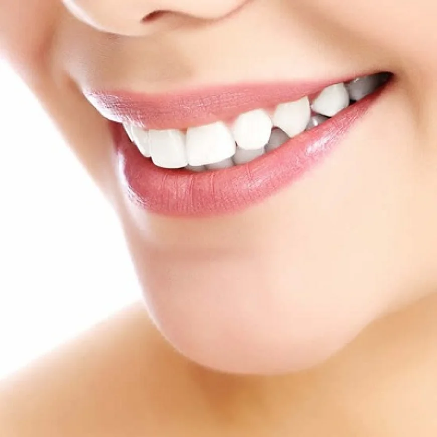Do Composite Veneers Look Like Natural Teeth?