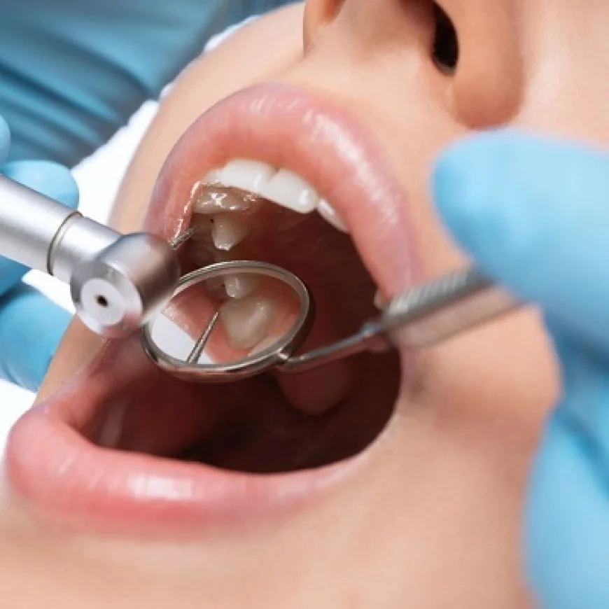 How Extractions Affect Bone Health