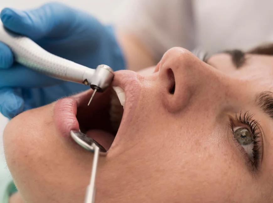 Are Cosmetic Dentistry Results Permanent in Houston, Texas?