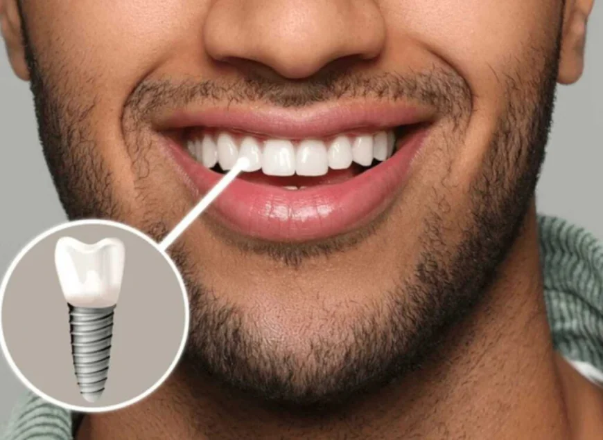 Are Dental Implants in Dubai safe long-term?