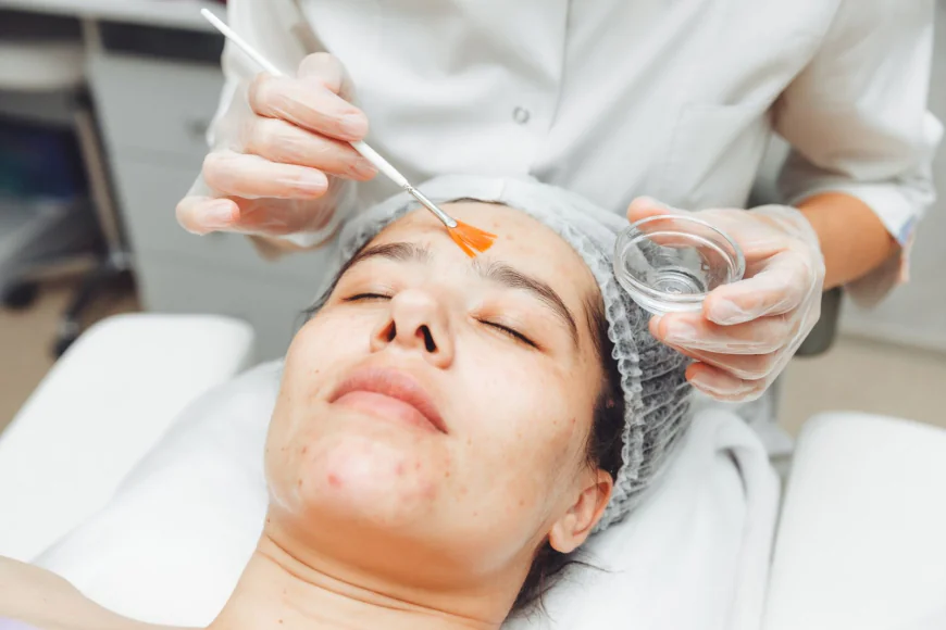 How Cold Peel Boosts Skin Renewal