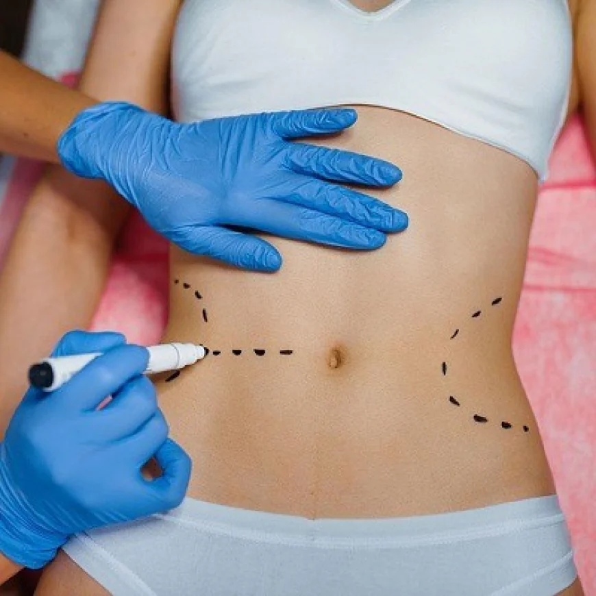 نتائج جراحة إنقاص الوزن قصيرة الأمد مقابل طويلة الأمد