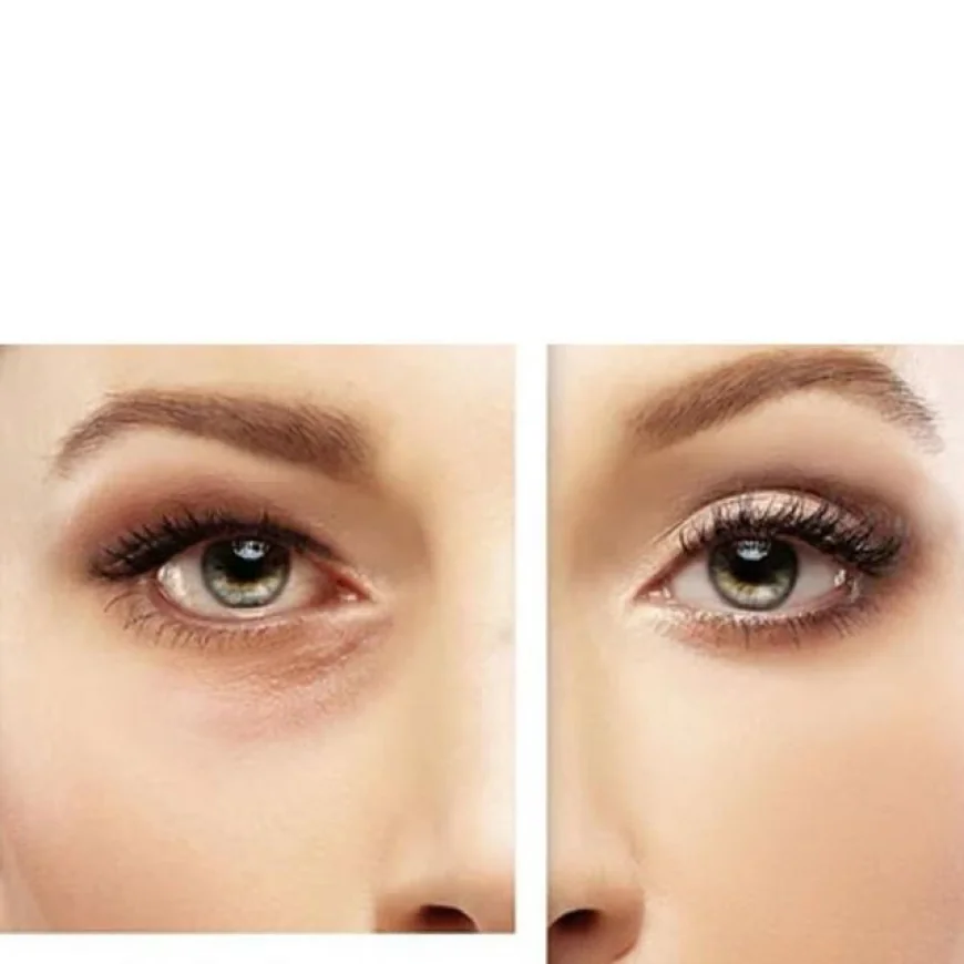 Plexr Plasma Eye Lift in Riyadh: A Non-Invasive Alternative to Traditional Blepharoplasty