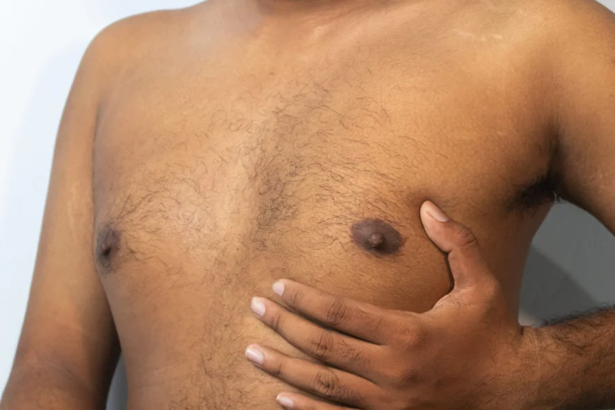 How to Reduce Gynecomastia in Dubai?
