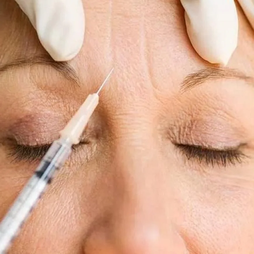 حقن البوتوكس لعلاج فرط التعرق: دليل التحكم في التعرق