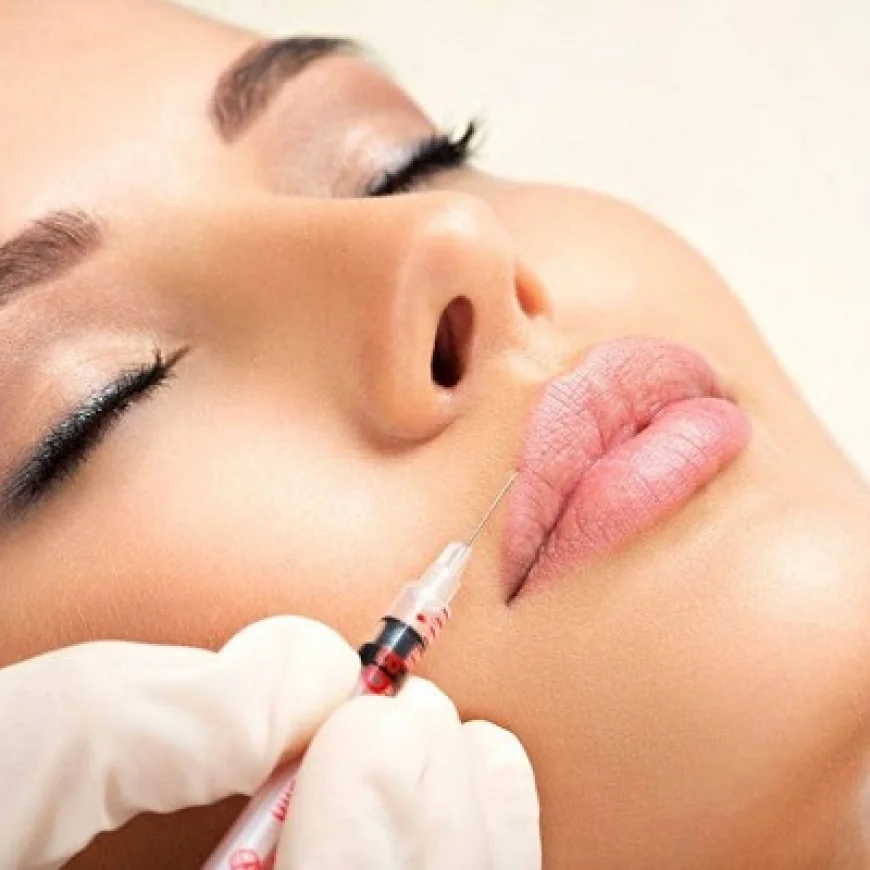 حقن فيلر الشفاه لمظهر شبابي