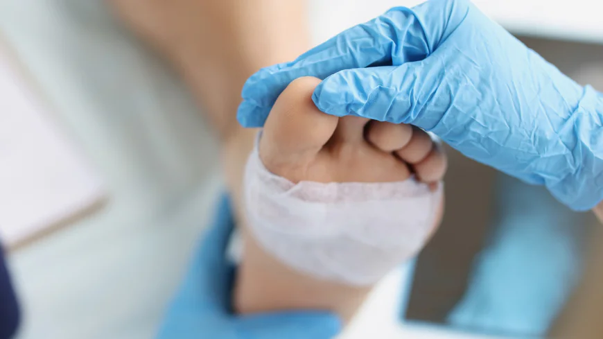 Does Wound Dressing at home in Dubai reduce infection?