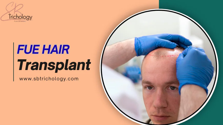 Can You Get PRP After FUE Hair Transplant Surgery?