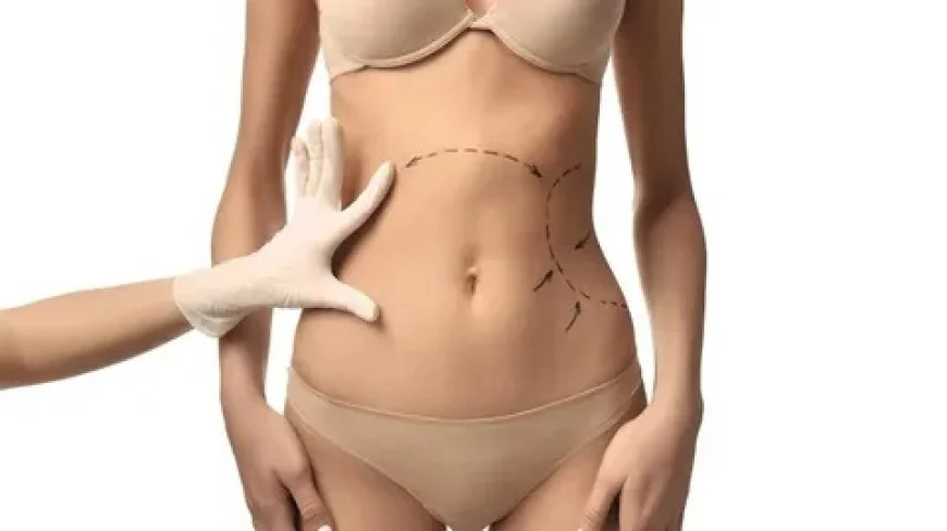 Top Questions About Body Contouring in Islamabad Answered