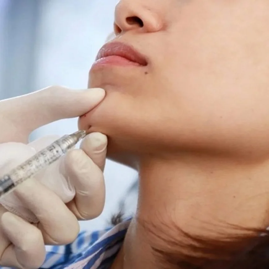 هل يمكن لحشو الذقن أن يساعد في علاج ترهل خط الفك؟