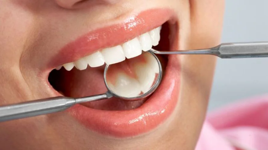 Tooth Cavity Treatment: Symptoms, Solutions, and Cost in Karachi