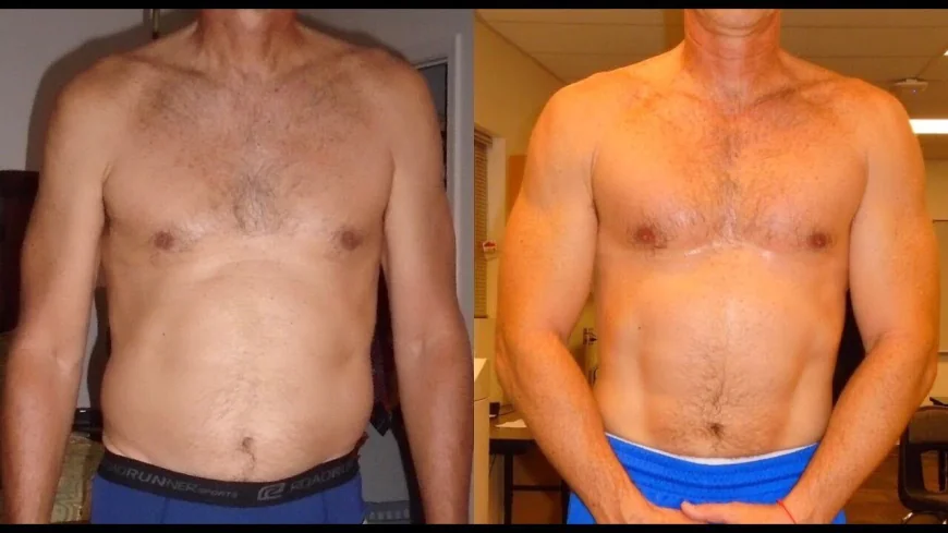 Diet and Fitness Before Tummy Tuck in Islamabad