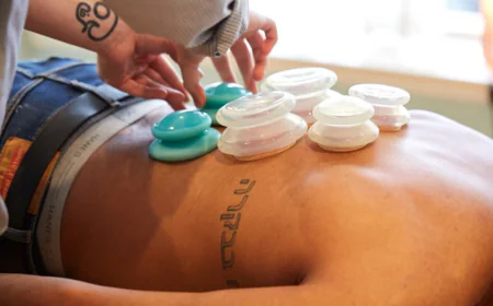 Cupping Therapy in Philadelphia: A Modern Take on an Ancient Practice