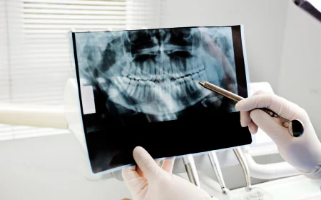 The Importance of Oral Cancer Screening in Dental Exams