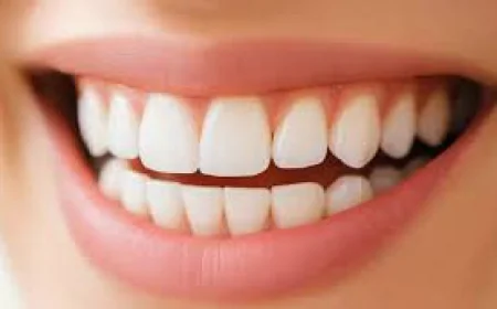 Top 10 Mistakes to Avoid When Getting a Hollywood Smile
