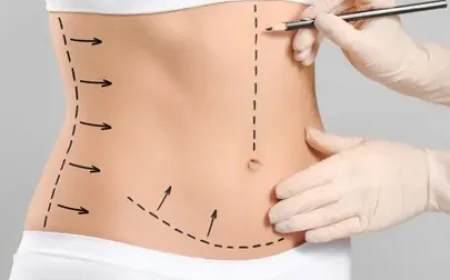 The Science Behind Circumferential Abdominoplasty in Islamabad