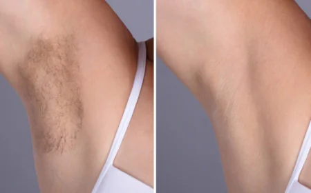 Best Plastic Surgeons in Dubai Reveal Secrets to Lasting Laser Hair Removal Results