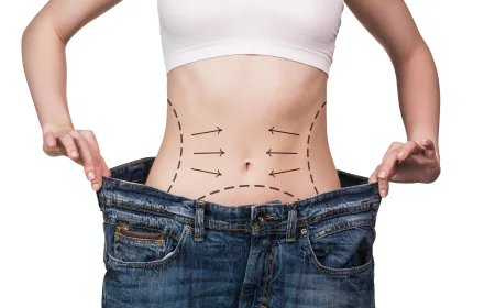 The Modern Techniques Used for Tummy Tuck in Islamabad