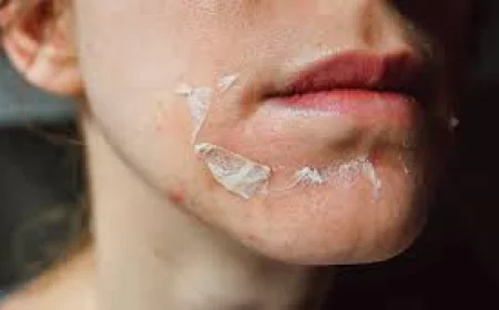 Can Chemical Peeling Help With Wrinkles?