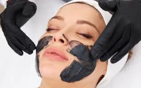 How Does Spectra Laser Carbon Peeling Compare to Chemical Peels?