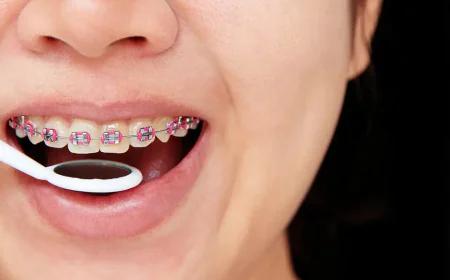 Can You Eat Popcorn with Metal Braces?