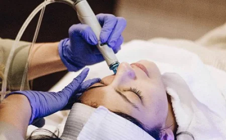 Laser Skin Resurfacing for Stretch Marks: Is It Effective?