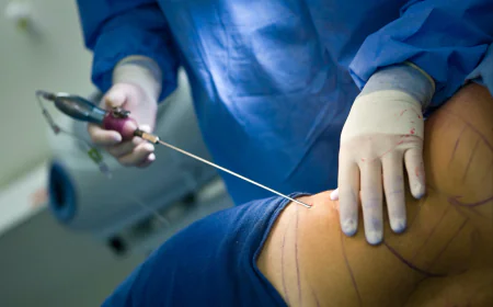 Is Liposuction Right for You? A Beginner’s Guide