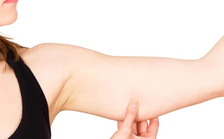 How Long Is the Recovery Period After Arm Liposuction?